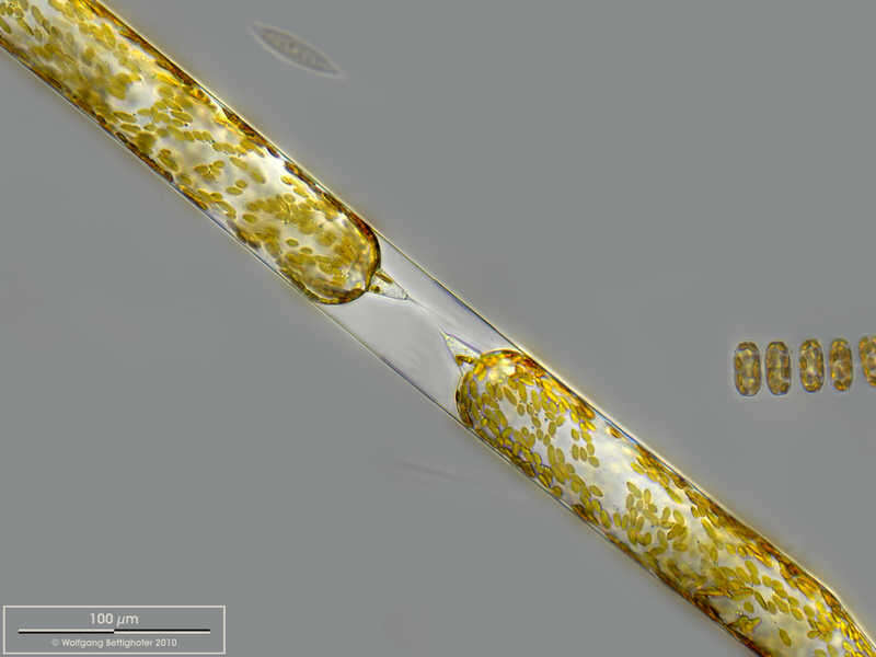 Image of Rhizosolenia Brightwell 1858