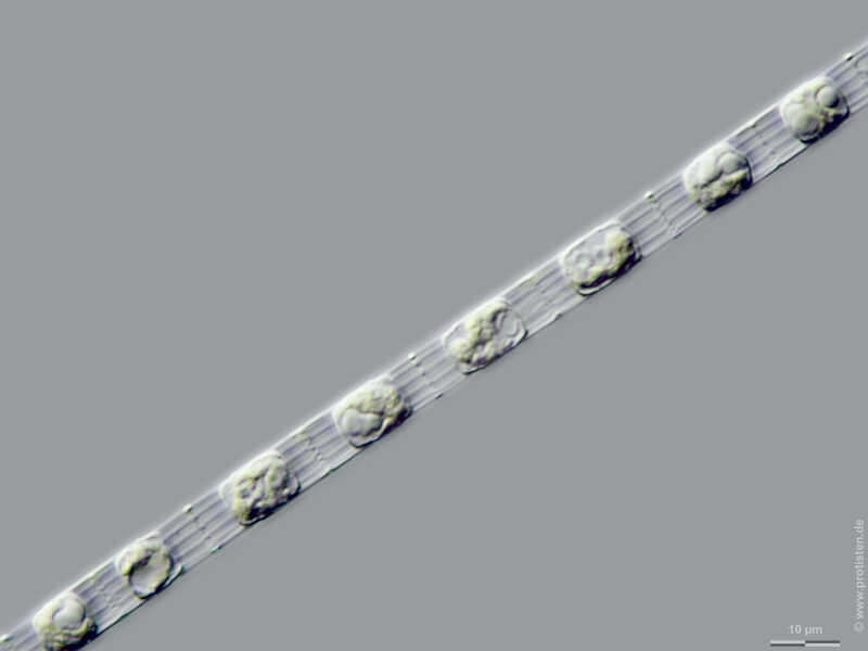 Image of Skeletonemataceae