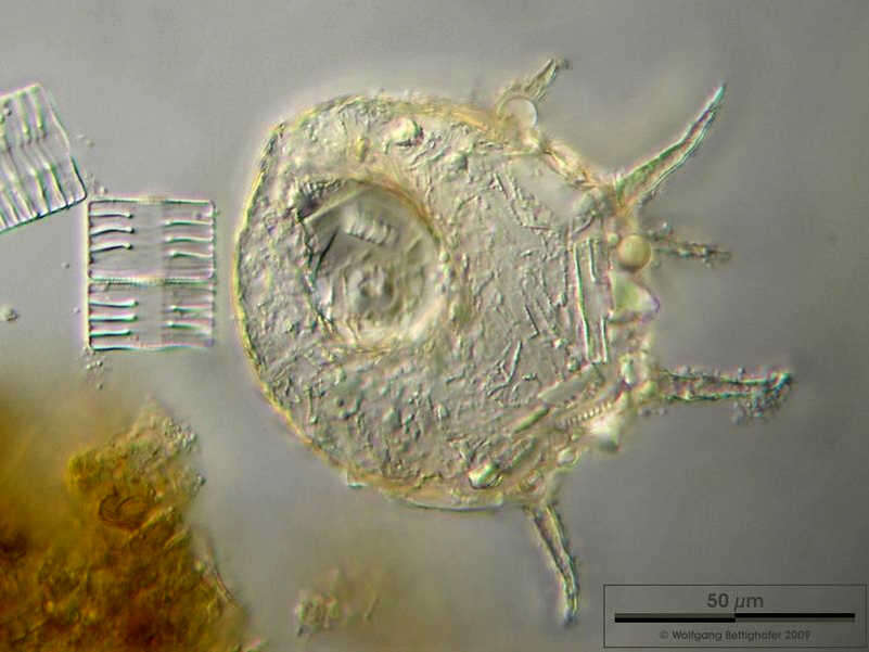 Image of Centropyxis aculeata (Ehrenberg 1838)