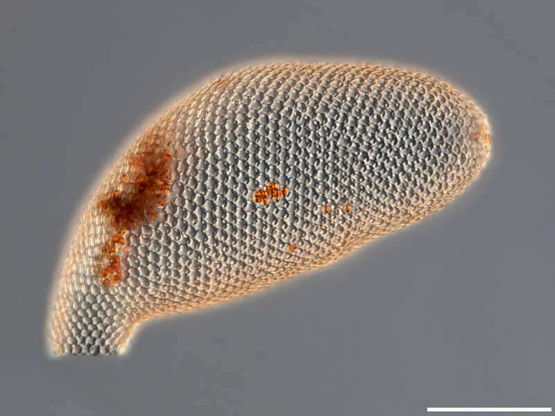 Image of Cyphoderia ampulla