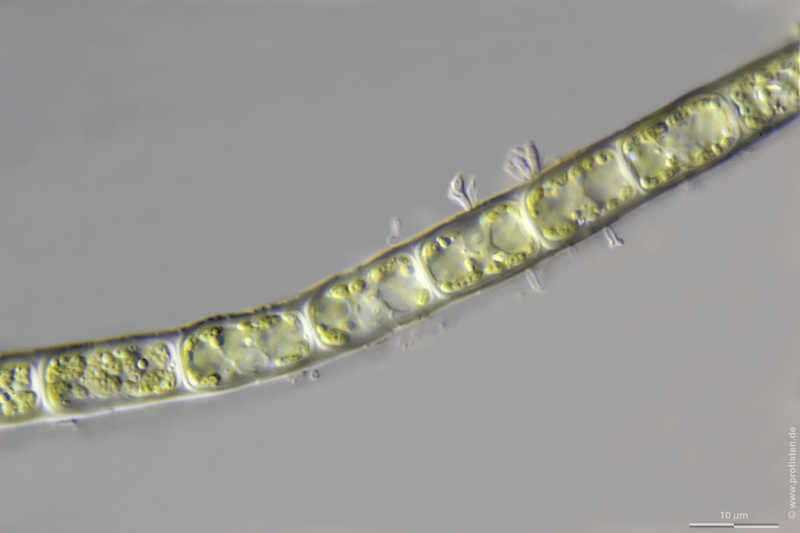 Image of Microspora tumidula Hazen 1902