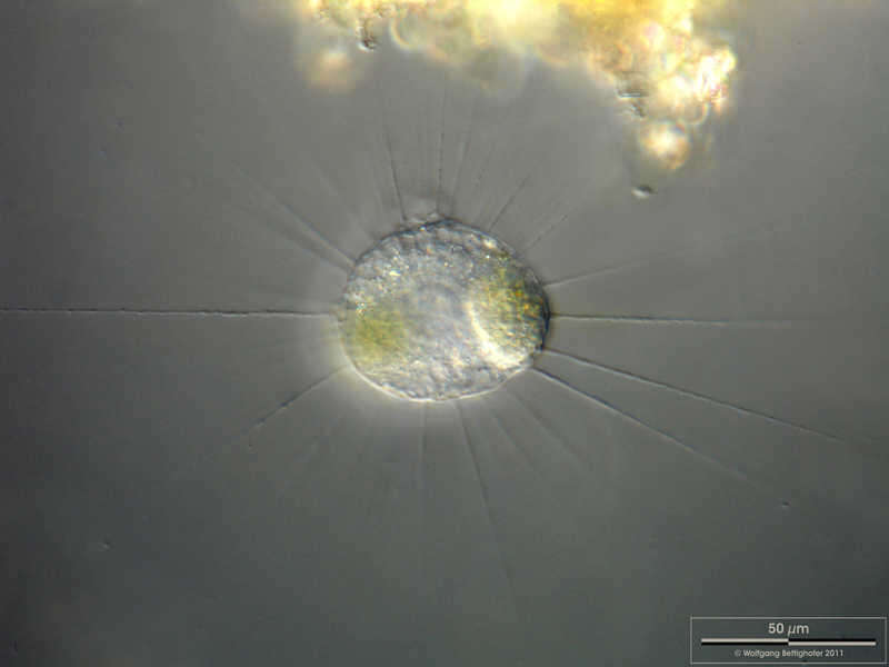 Image of Actinophrys sol