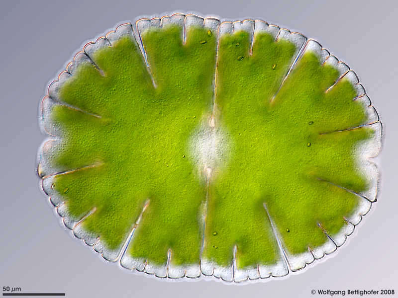 Image of Micrasterias denticulata