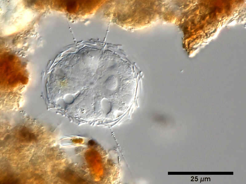 Image of Raphidocystis marginata (Siemensma 1981) Zlatogursky 2018