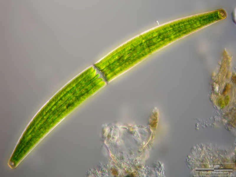 Image of Closterium striolatum Ehrenberg ex Ralfs 1848