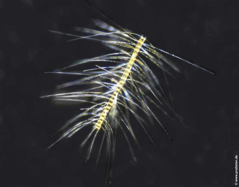 Image of Chaetoceros eibenii