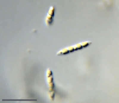 Image of Macromonas fusiformis Deflandre