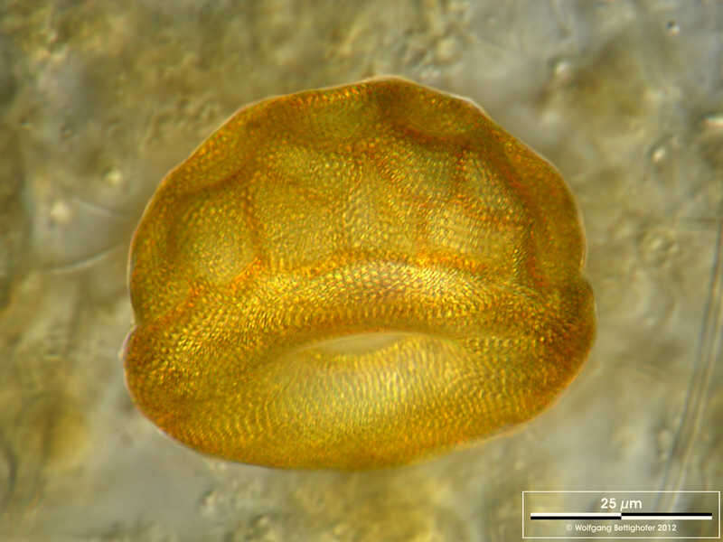 Image of Arcella gibbosa