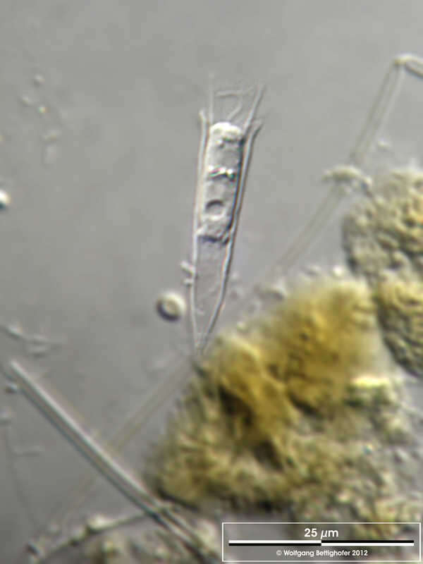 Image of Salpingoeca vaginicola Stein