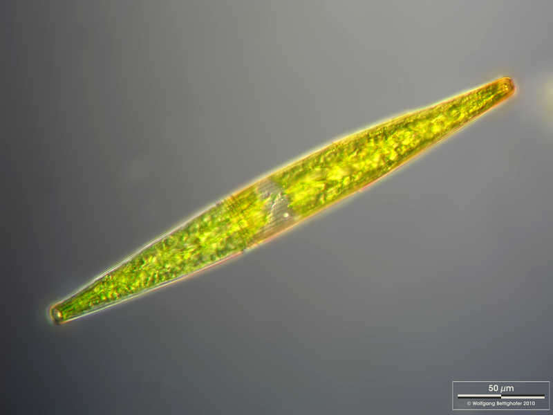 Image of Closterium striolatum Ehrenberg ex Ralfs 1848