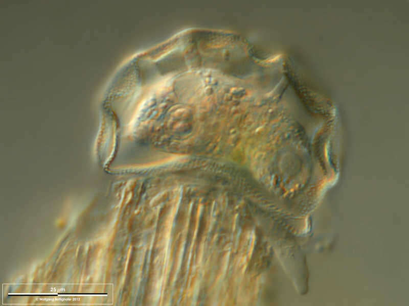 Image of Arcella hemisphaerica