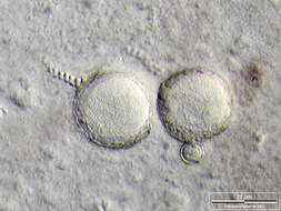 Image of Vorticella similis
