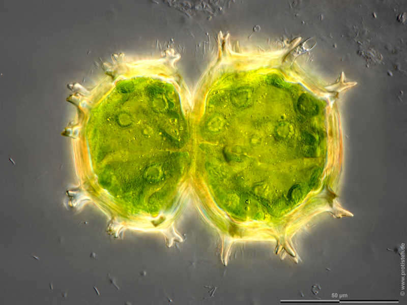 Image of Xanthidium armatum