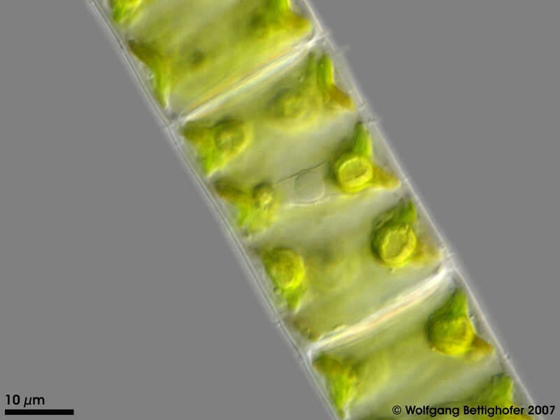 Image of Spirogyra Link 1820