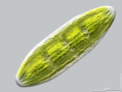 Image of Planotaenium (Ohtani) Petlovany & Palamar-Mordvintseva 2009