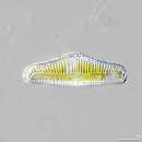 Image of Rhopalodia gibba