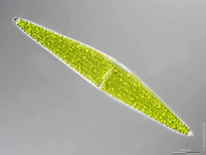 Image of Closterium lunula