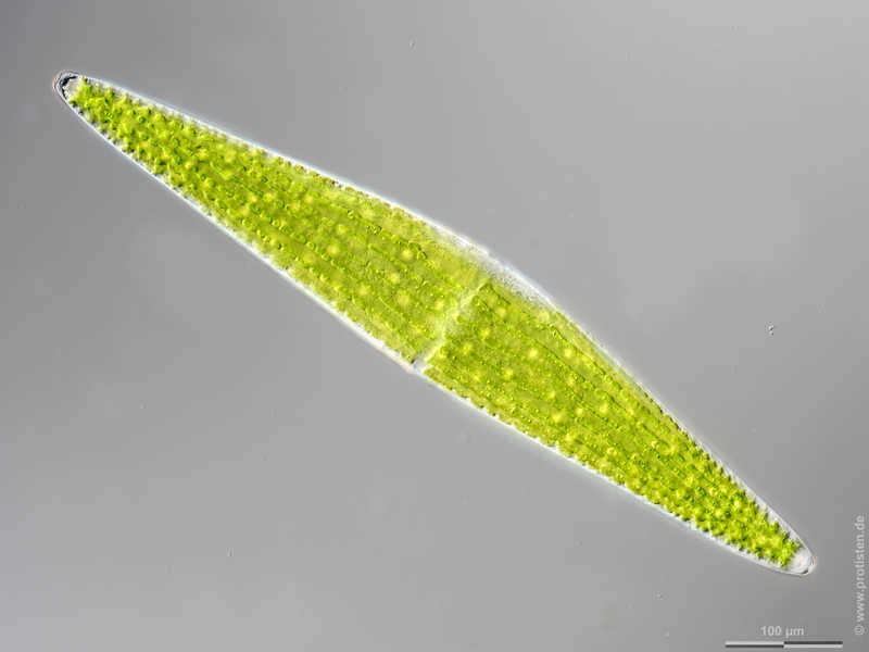 Image of Closterium lunula