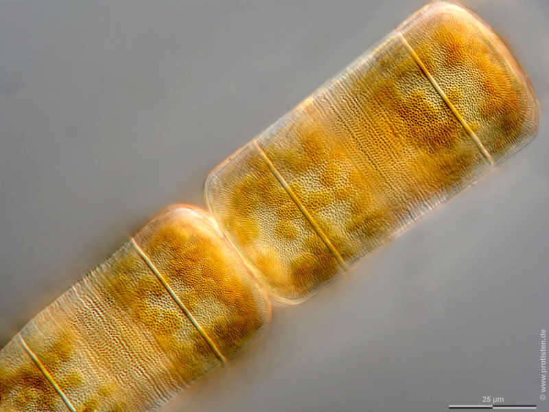 Image of Melosira moniliformis