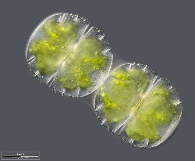 Image of Micrasterias truncata Brébisson ex Ralfs 1848