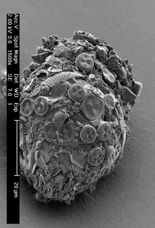 Codonella cratera Leidy 1887的圖片