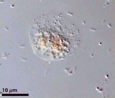 Image of Hyalodiscus