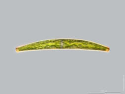 Image of Closterium striolatum Ehrenberg ex Ralfs 1848