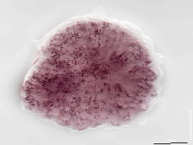 Image of Zonomyxa violacea Nüsslin 1882