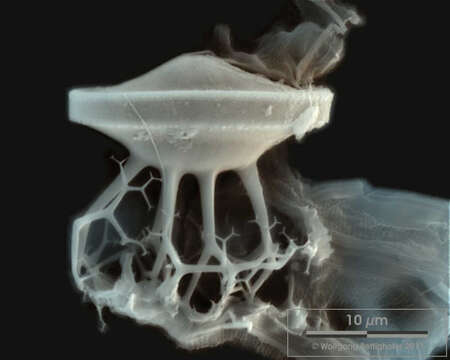 Image of Chaetoceros diadema