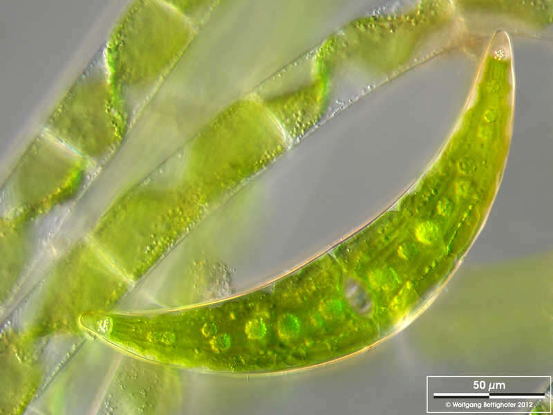 Image of Closterium moniliferum