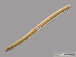 صورة Nitzschia sigmoidea