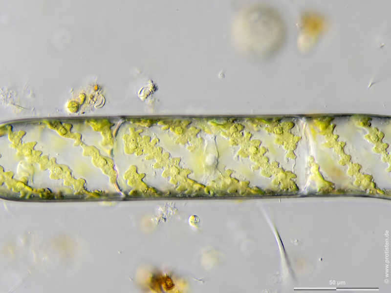 Image of Spirogyra Link 1820