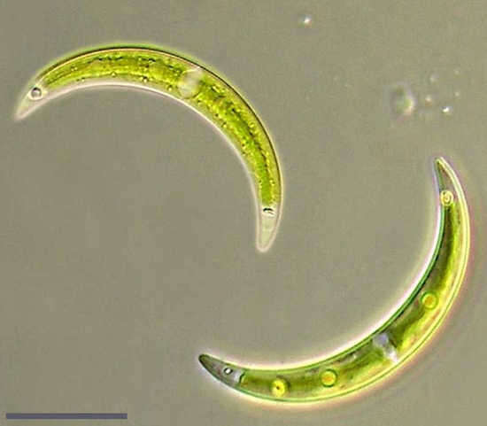 Image of Closterium incurvum