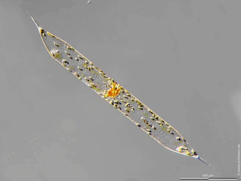 Image of Pseudosolenia calcar-avis