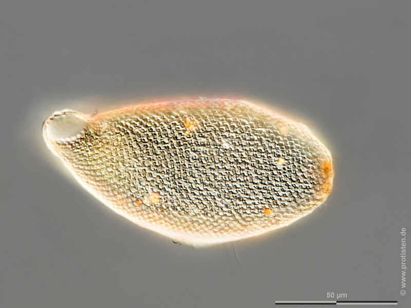 Image of Cyphoderia ampulla
