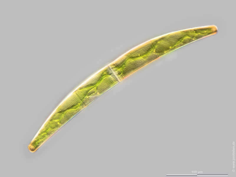 Image of Closterium striolatum Ehrenberg ex Ralfs 1848