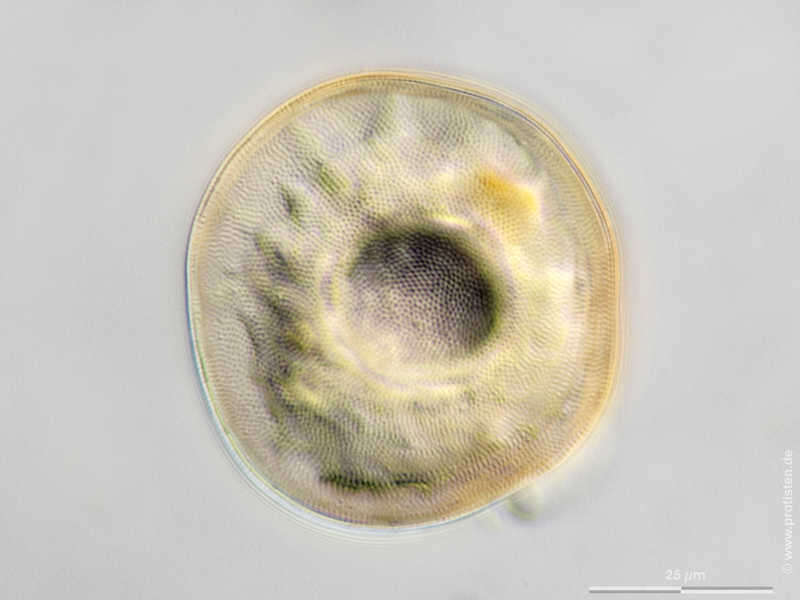 Image of Arcellidae