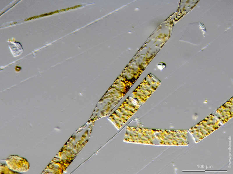 Image of Pseudosolenia calcar-avis