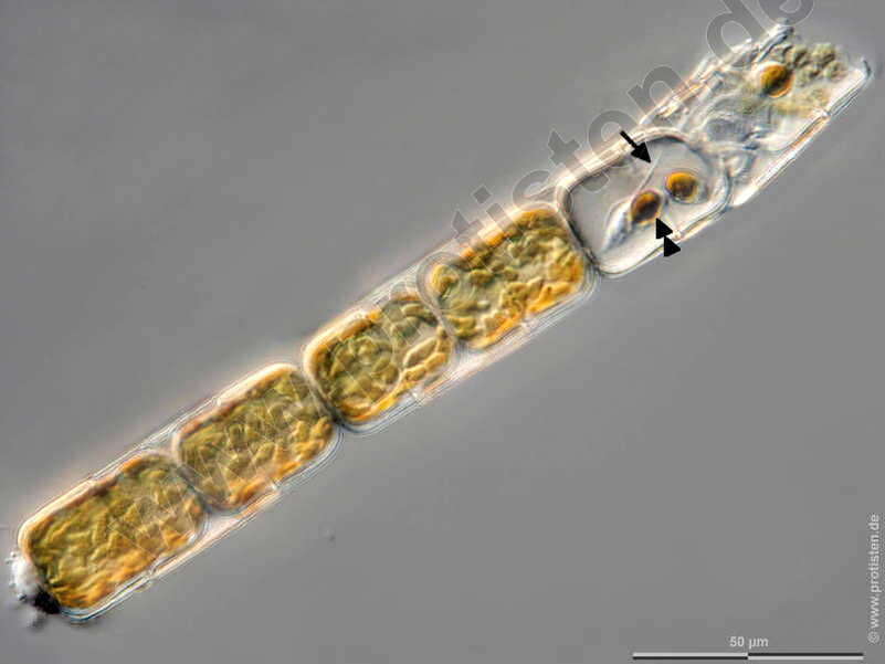 Image of Melosira moniliformis