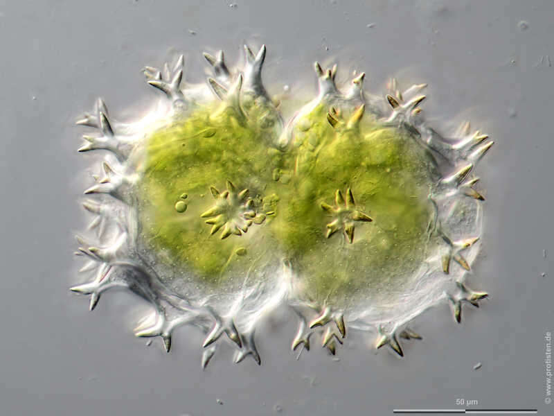 Image of Xanthidium armatum