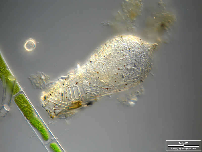 Image of Difflugia ventricosa Deflandre 1926