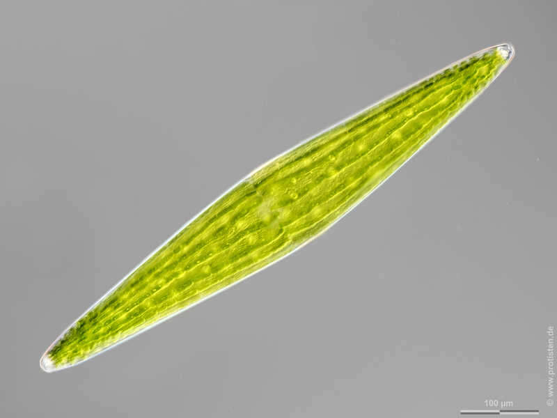 Image of Closterium lunula