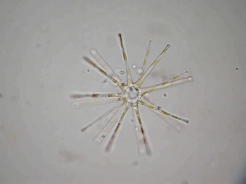 Image of Asterionella formosa