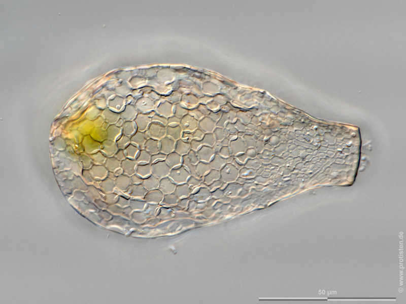 Image of Gibbocarina Kosakyan, Lahr, Mulot, Meisterfeld, Mitchell & Lara 2016