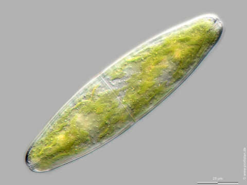 Image of Tetmemorus granulatus var. granulatus (Bréb) Ralfs ex Ralfs 1848
