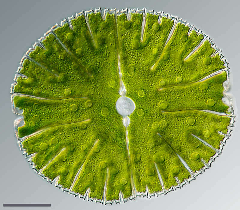 Image of Micrasterias thomasiana var. notata