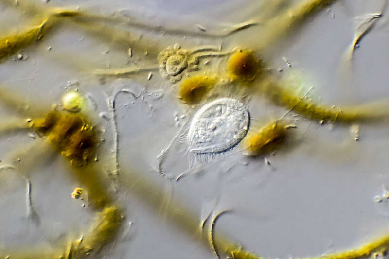 Image of Calyptotricha lanuginosa (Penard 1922) Wilbert & Foissner 1980