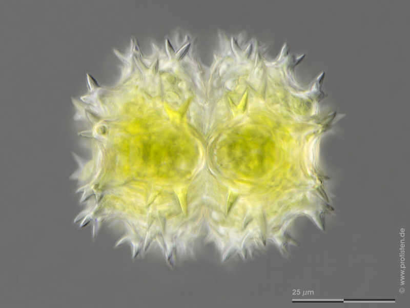 Image of Staurastrum spongiosum var. perbifidum West 1892