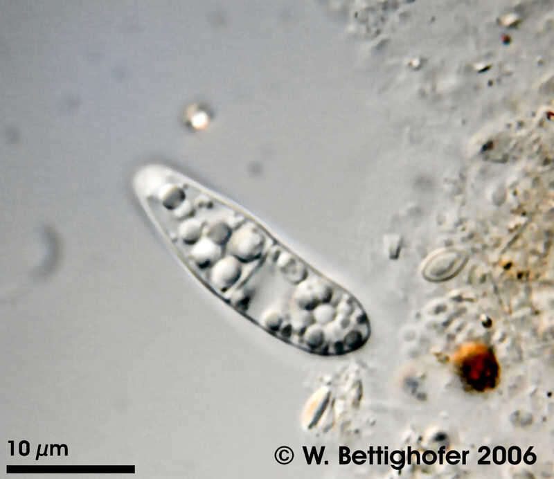 Image de Achromatium oxaliferum