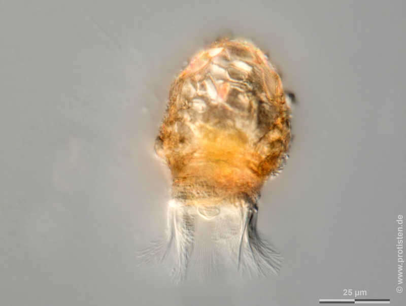 Stenosemella oliva (Meunier 1910)的圖片